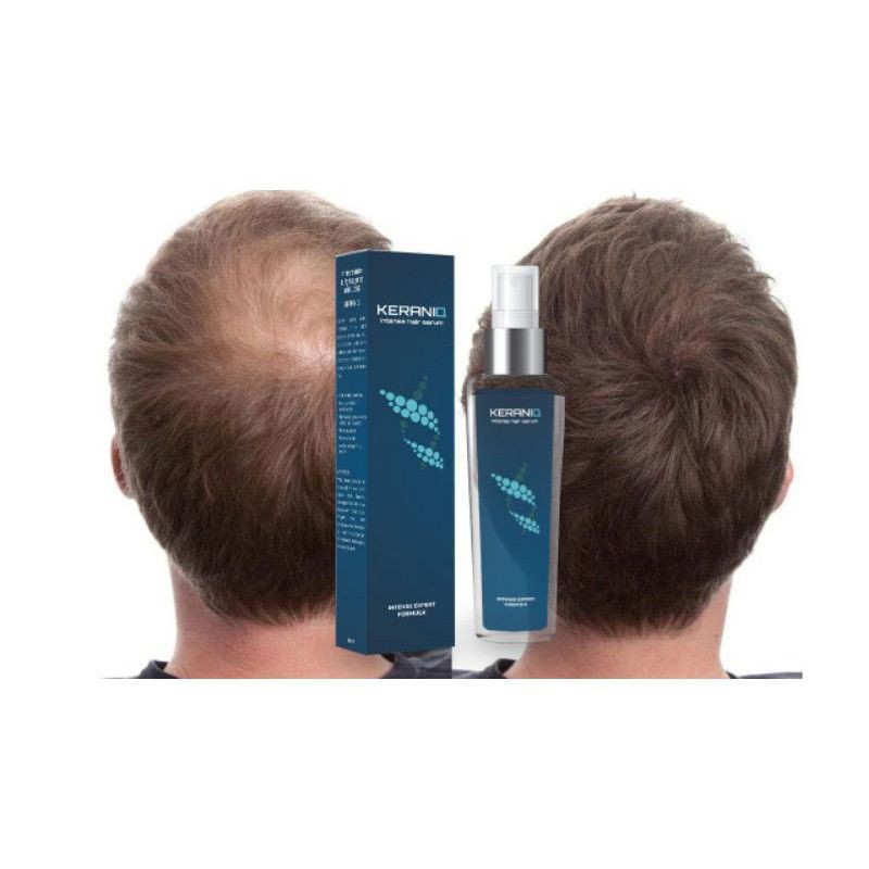 KERANIQ Hair Serum Penumbuh Penyubur Rambut Original
