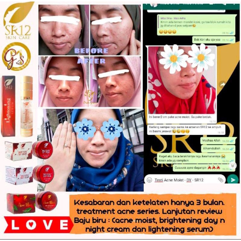 SERUM LIGHTENING SR12 HERBAL SKINCARE BPOM- SERUM PEMUTIH WAJAH BPOM - SERUM ANTIOKSIDAN MEMUTIHKAN WAJAH - SERUM GLOWING -