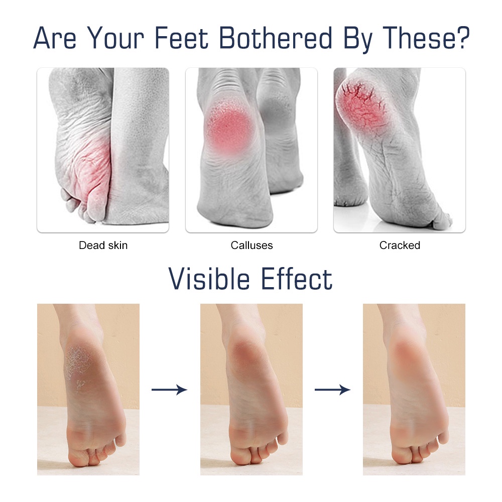 Salorie Alat Kikir Kaki / Tangan Untuk Pedicure