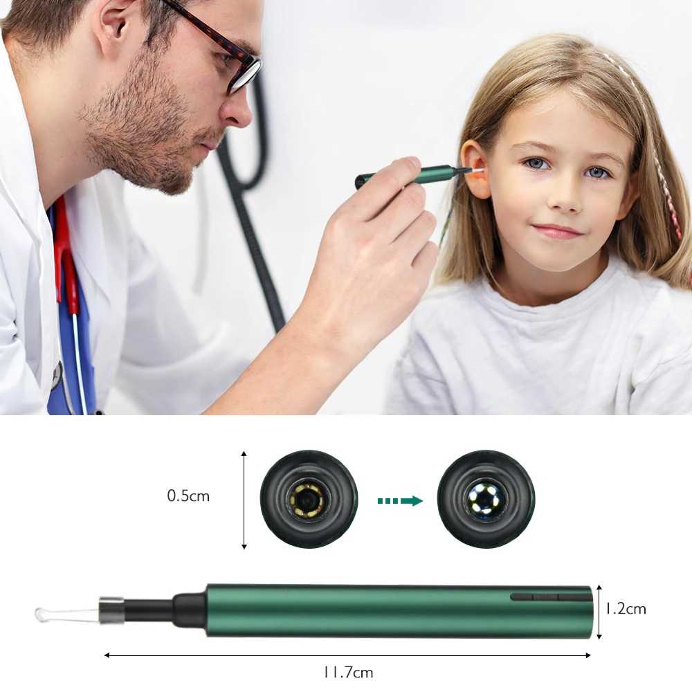 Ear Camera Endoscope For i phone Smart Visual Pembersih Telinga Korek Kuping Dengan Kamera Konek WiFi Lensa 5.5mm