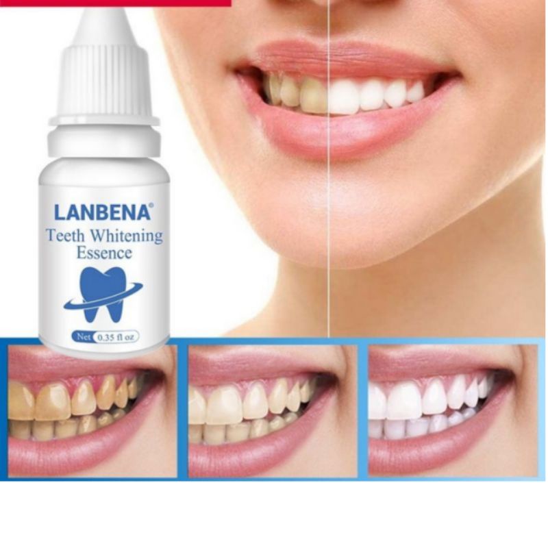 LANBENA PEMUTIH GIGI TEETH WHITENING