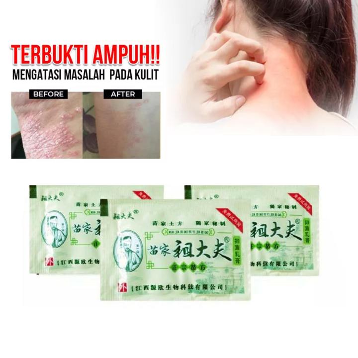 PAKET HEMAT OBAT GATAL 7 SACHET NETTO @3 gram Obat Kulit Gatal Jerawat Ruam Jamur Kudis Kurap Beri Beri ZUDAIFU