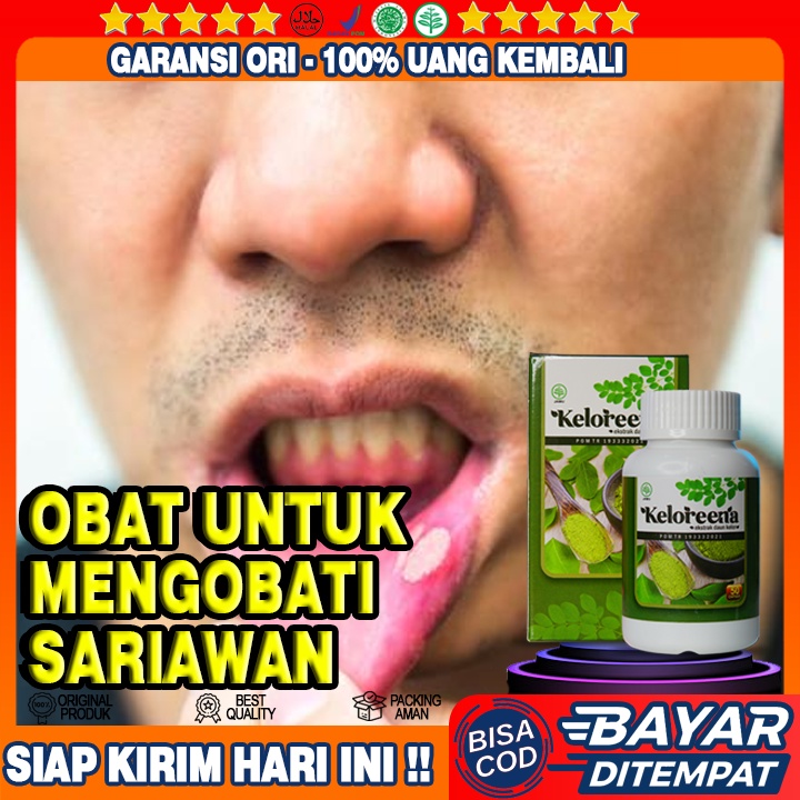 Obat Sariawan, Obat Sariawan Menahun, Obat Sariawan Di Gusi, Obat Sariawan Di Tenggorokan
