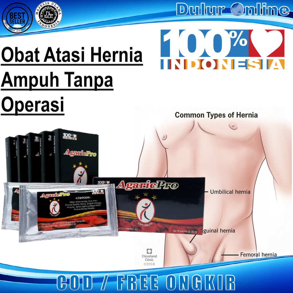 obat hidrokel,obat herbal hernia,usus turun,Agaricpro,obat turun berok pria,obat varikokel