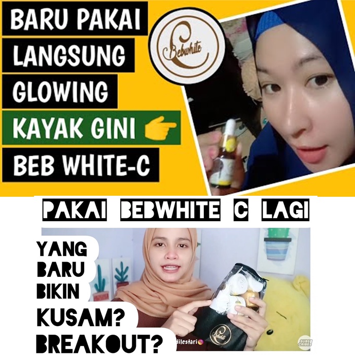 Skincare Bpom BEBWHITE C ECER | BBC Paket Glow Acne | Bebwhite Day Night Cream Serum Facial Wash Tot