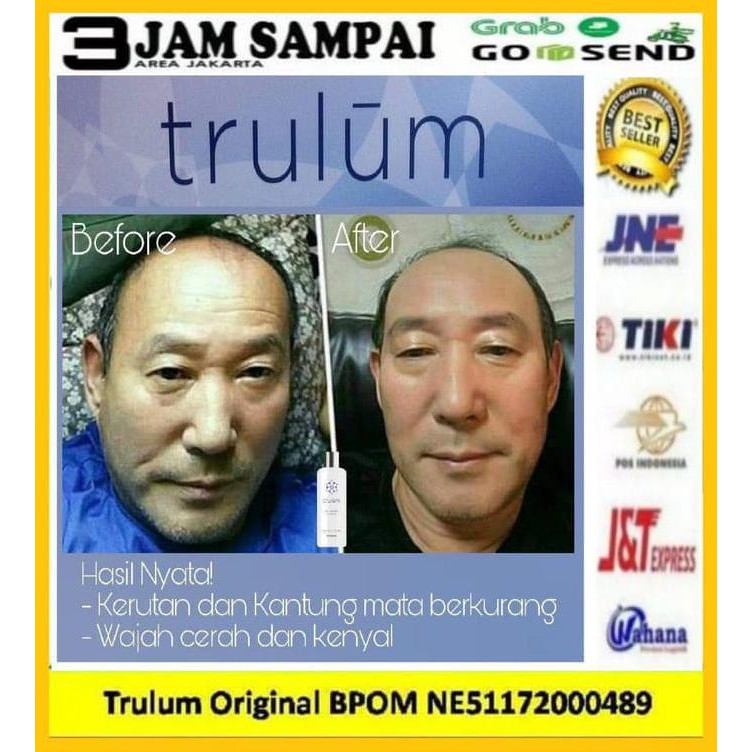 Mencegah Keriput Di Wajah | Trulum Penghilang Keriput Wajah Cepat