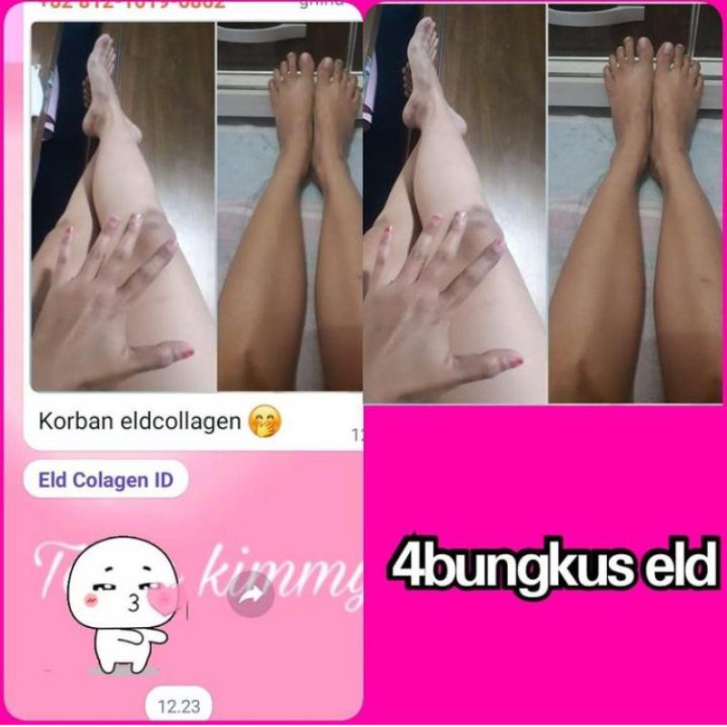 

ELD collagen Drink pemutih badan secara cepat