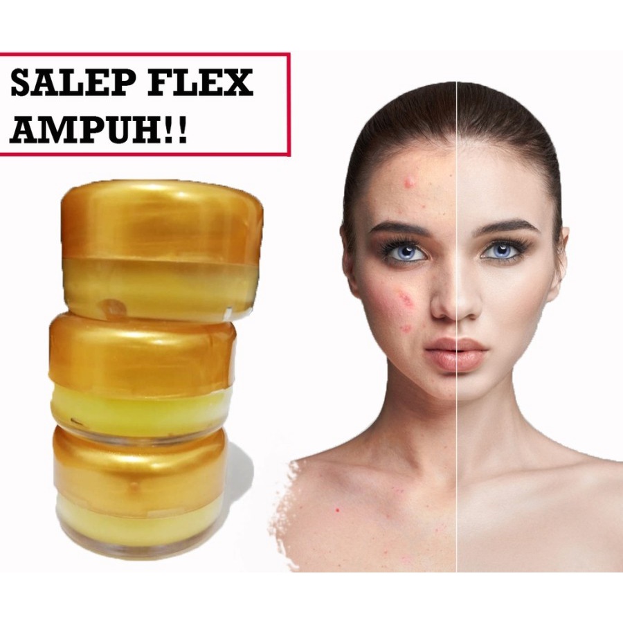 MURAH Salep Flek Hitam Membandel - SalepFlek Melasma Untuk Menghilangkan Flex Hitam / Salep Flex Hit