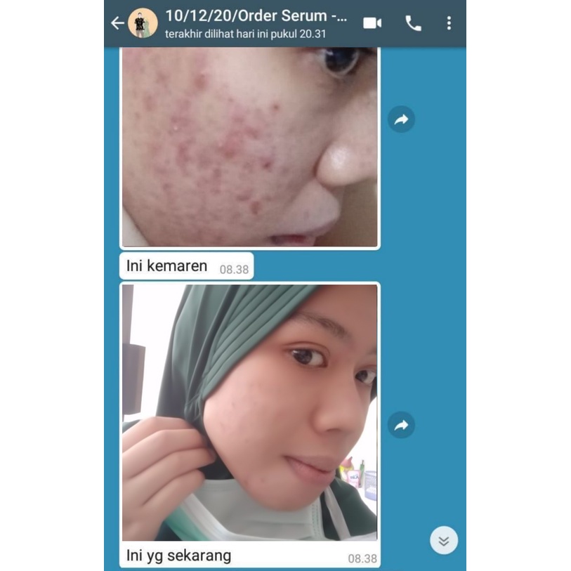 SERUM ADERA FACE SERUM ORIGINAL WAJAH ORI UNTUK FLEK HITAM GLOWING ORI BPOM ASLI 100% SERUM ADERA WAJAH ORI | ADERA SERUM WAJAH