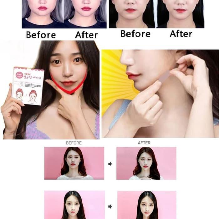 BWDO  Plester Pipi Penirus Wajah Isi 40 pcs Dodo Label V Stiker Muka Shape Korea Face Aman Praktis