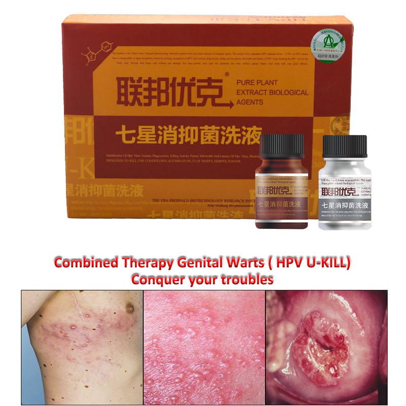 hpv warts removal