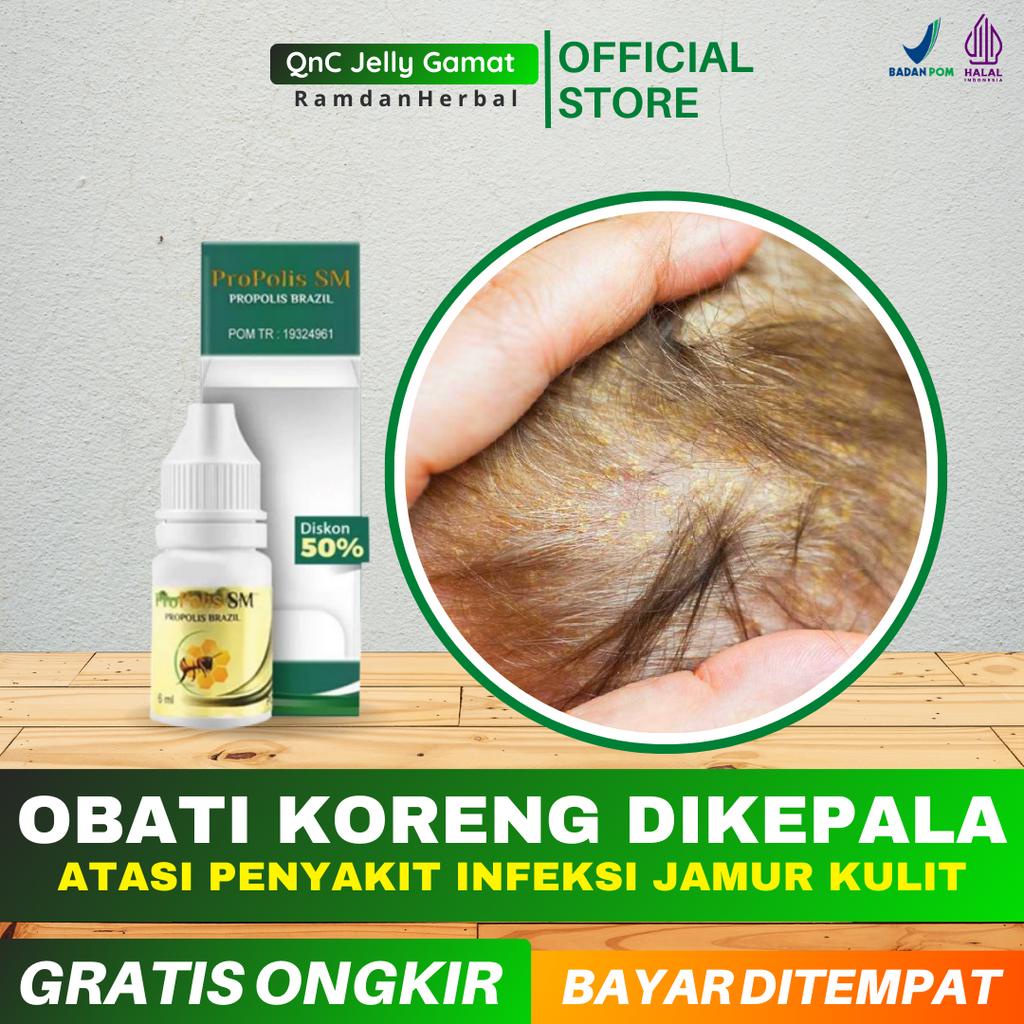 Obat Koreng Di Kepala Anak dan Dewasa_Korengan Di Kepala_Borok Di Kulit Kepala_Propolis SM ORIGINAL