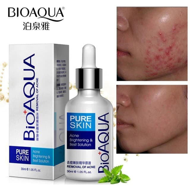 BIOAQUA PURE SKIN BESAR SERUM WAJAH ANTI JERAWAT ACNE REMOVAL 30 ML
