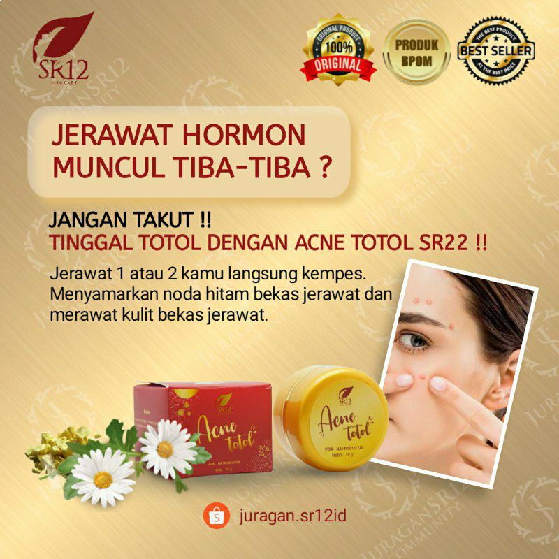 KRIM JERAWAT TOTOL SR12 BPOM AMAN / MENGEMPESKAN JERAWAT / CREAM TUMPAS JERAWAT / PERAWATAN JERAWAT