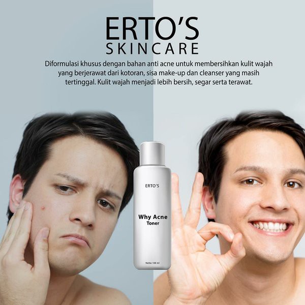 [COD] Why Acne Toner Anti Acne Penghilang Jerawat dan Bekas Jerawat AMPUH dalam 2 Minggu BPOM