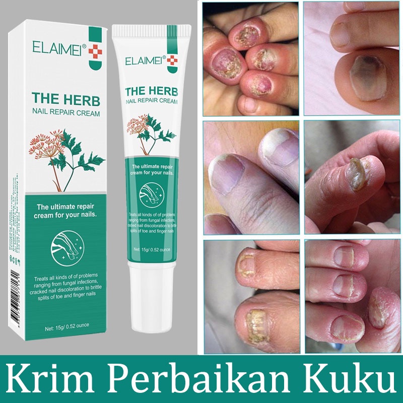 ELAIMEI Krim Perbaikan Kuku 15g Lembut Krim Kuku Shu Krim Perbaikan Kuku Tanaman Cerah Perawatan Kuku Kuku Onikomi Cream