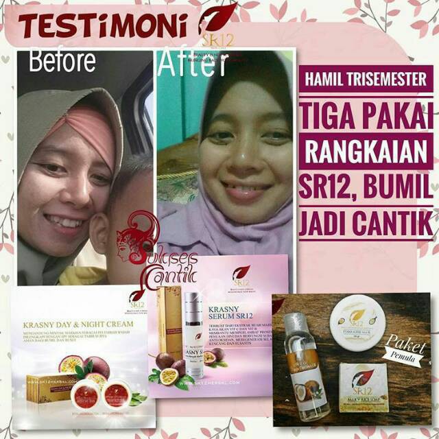 KRASNY SERUM SR12 - SERUM VIT C SERUM KULIT KERING SERUM MARKISA BPOM REGENERASI SEL