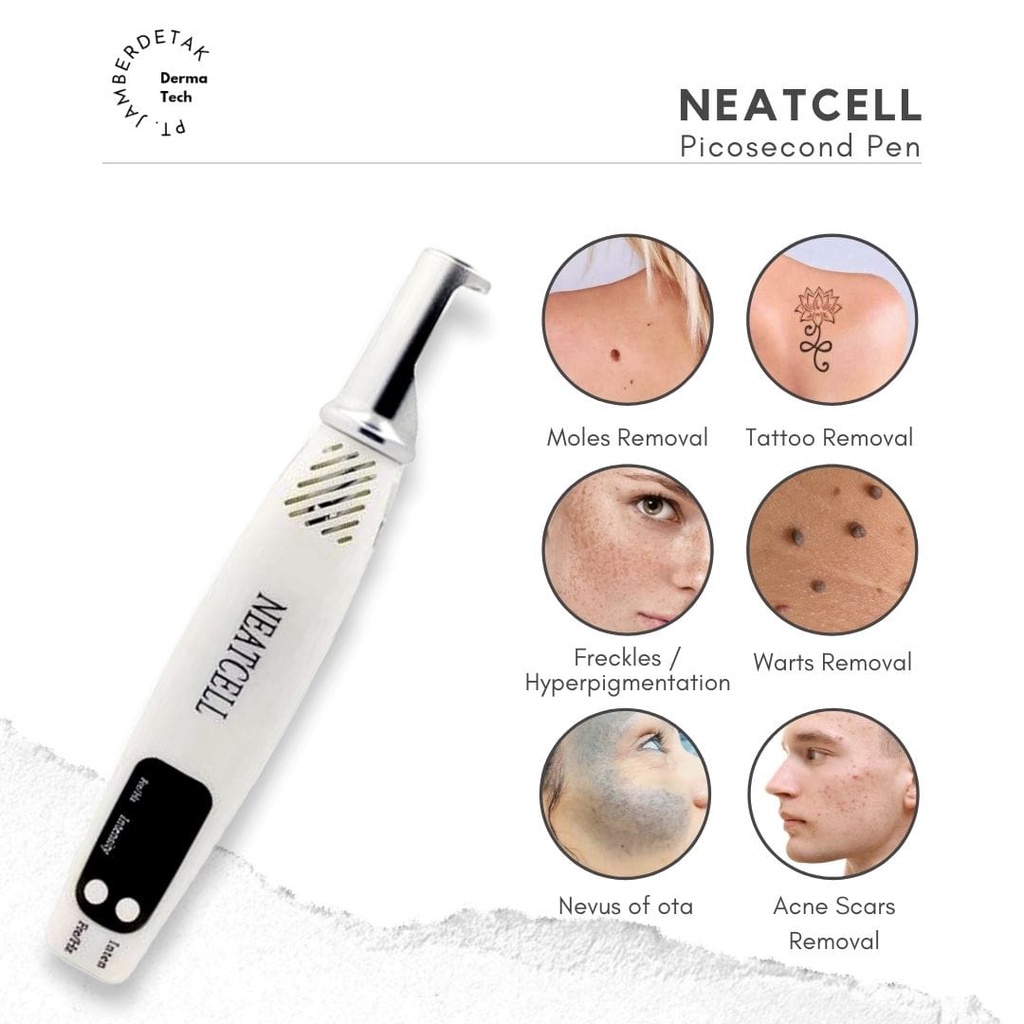 Picosecond alat laser penghilang flek bekas jerawat tato tai lalat kutil black spot mole removal