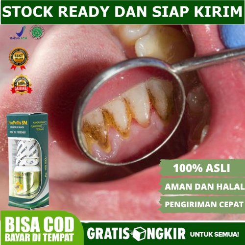 obat  penghilang  gigi kuning - Obat karang gigi - Pemutih gigi dan karang gigi - Penghilang karang 