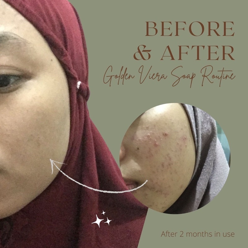 Golden Viera Herbal Soap Original Kemasan Baru Bebas Pilih Hadiah