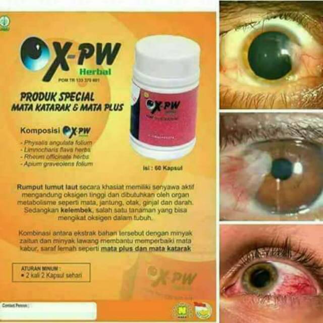 Ox Pw Produk Special Untuk Mata Katarak Dan Mata Plus Herbal Nasa Resmi Shopee Indonesia