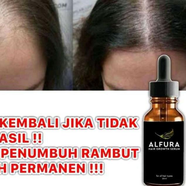 ℗ Alfura Serum Penumbuh Alami Rambut Jenggot Alis Permanen ☈