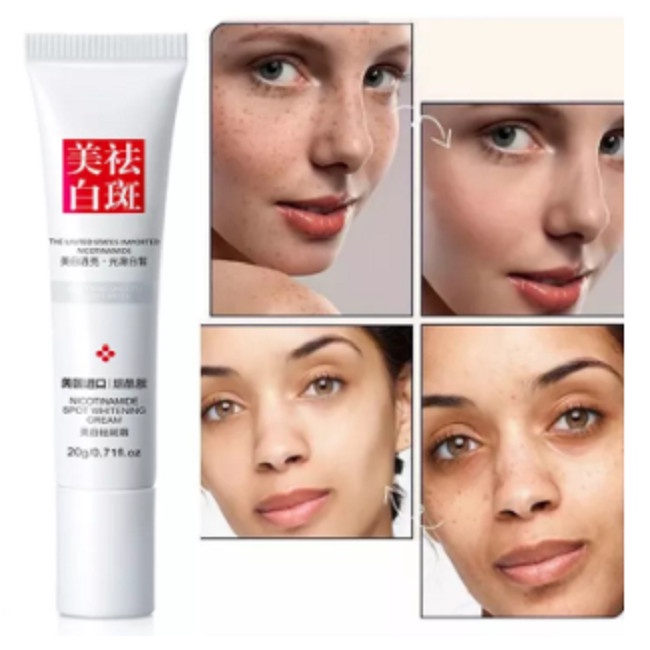 Cream Pencerah Wajah Kusam Bintik Bintik Hitam