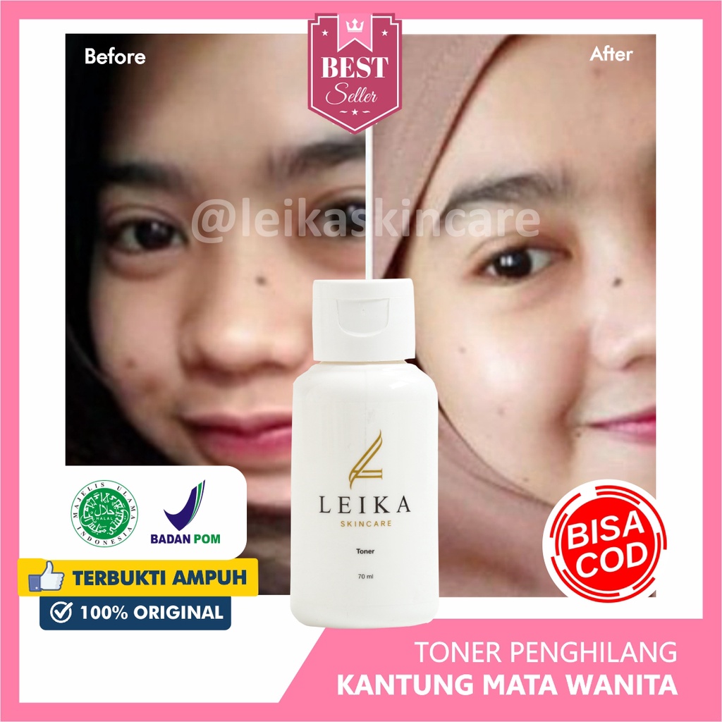 Terlaris Toner Penghilang Kantung Mata Ampuh Bpom Obat Kantung Mata penghilang kantong mata penghila