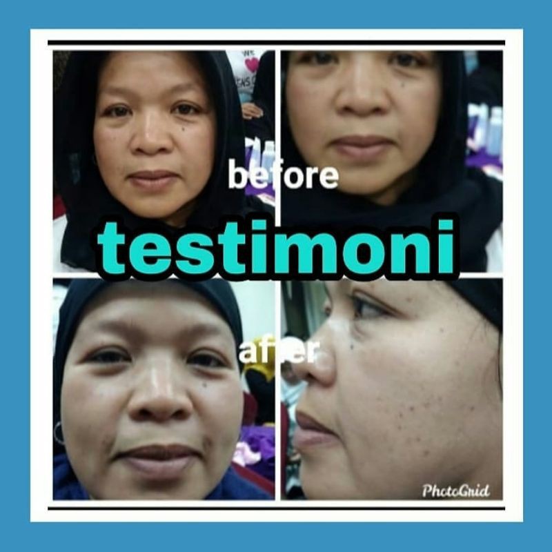 

herbal kecantikan ori