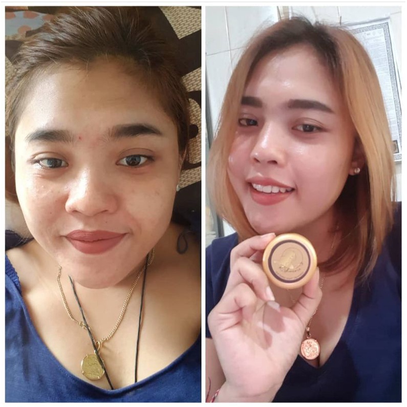 RL SKINCARE CEPAT GLOWING DAN AMAN SUDAH BPOM RI. cream malam dan sabun