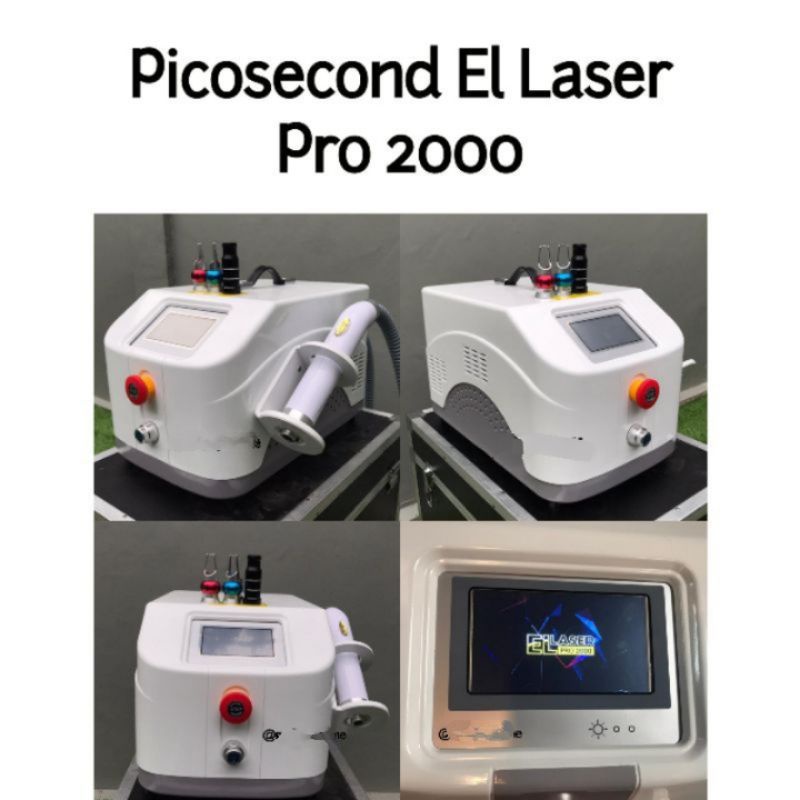 Laser Hapus Tato