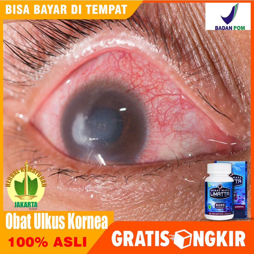 Limatta Sehat Mata Softgel Herbal Obat Spesialis Untuk Mata, Ulkus Kornea, Katarak, Minus, Rabun Sud