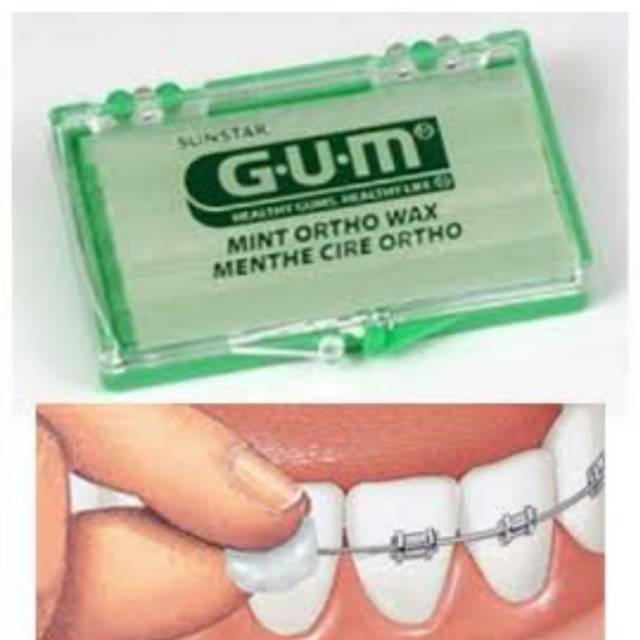 GUM Sunstar Ortho Wax  Lilin Gigi Gum Lilin Behel