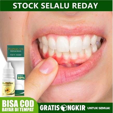Obat Gusi Bengkak, Gusi Berdarah, Radang Gusi, Infeksi Gigi, Abses Gigi, Penghancur Gigi Berlubang