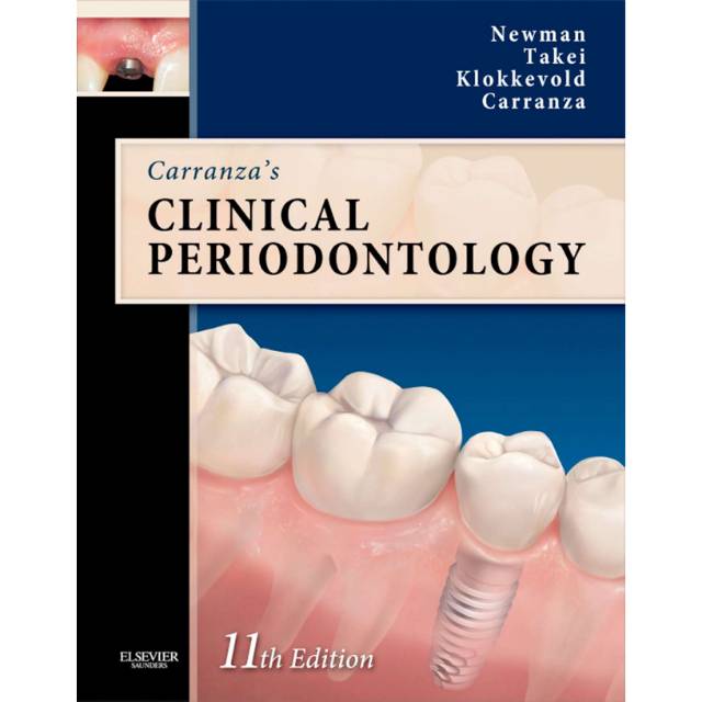 CLINICAL PERIODONTOLOGY, 11th Edition