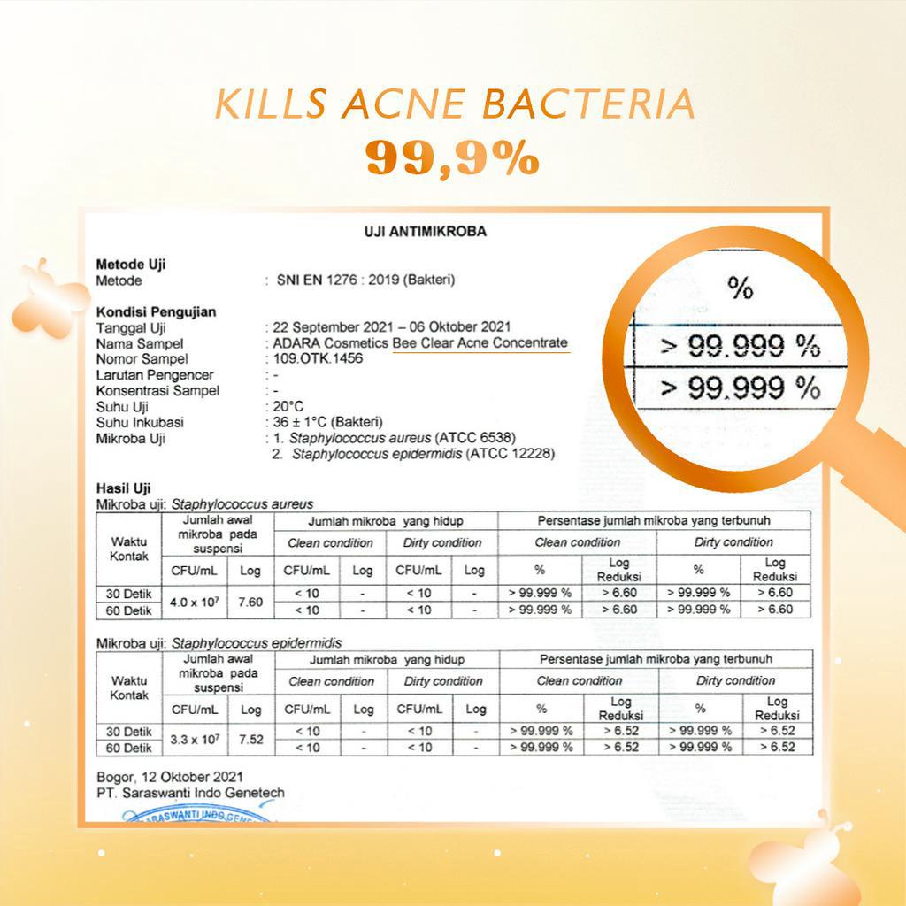 [Best Seller Acne Bundle] ADARA - Enzyme Wash + Acne Gel Extra Formula + Spotless Gel/Cream