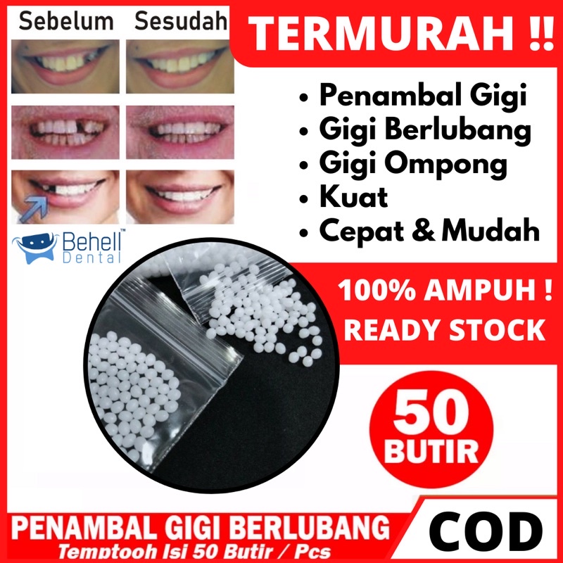 TERMURAH !! 500 BUTIR TEMPTOOTH GIGI PALSU SEMENTARA PENAMBAL GIGI PATAH RENGGANG / TEMTOOTH / BAHAN TAMBAL GIGI BOLONG BERLUBANG / TEMPORARY TOOTH INSTAN PRAKTIS / TEMPTOOTH GINGSUL PATAH LEM TIRUAN MURAH ORIGINAL ISI 200 / 500 / 400 / 150 / 100 BUTIRi