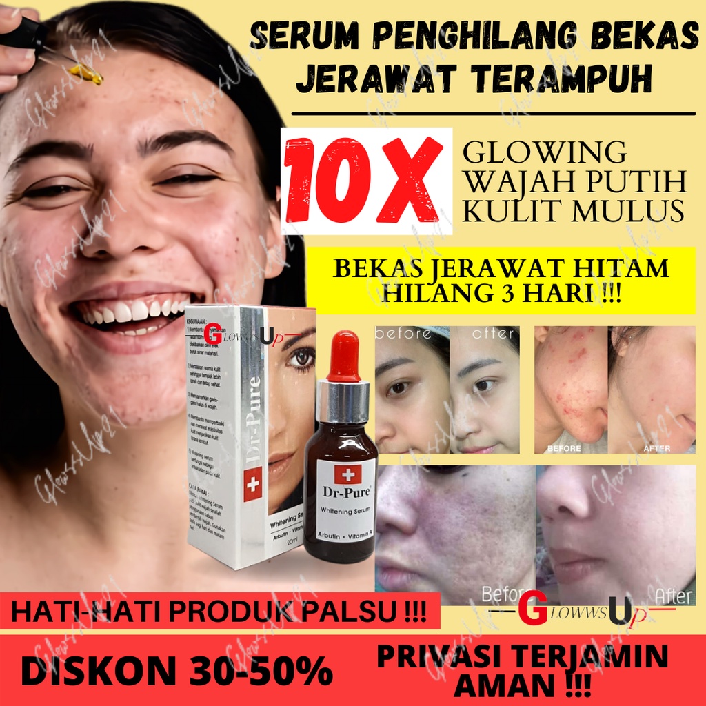 SERUM PENCERAH WAJAH PENGHILANG BEKAS JERAWAT DR PURE SERUM WHITENING BPOM ORIGINAL