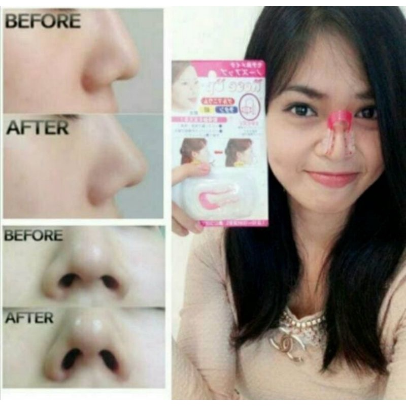 Penjepit hidung mancung alat pemancung hidung Nose UP clipper silicone