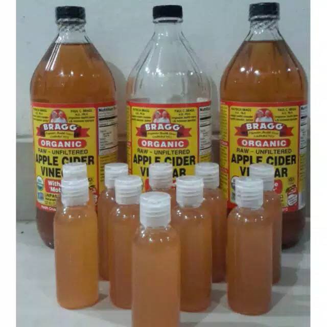 Toner cuka apel bragg 100% original/cuka apel organic/toner pemutih/cuka apel asli/toner jerawat