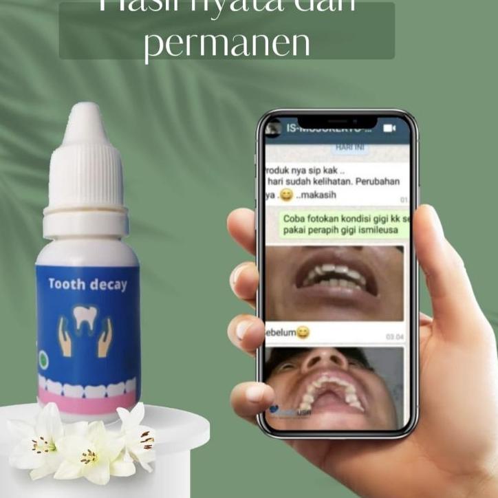 ☄️Harga Baru TOOTH DECAY {Penumbuh Gigi Ompong & Gigi Berlubang} BISA COD #TREND