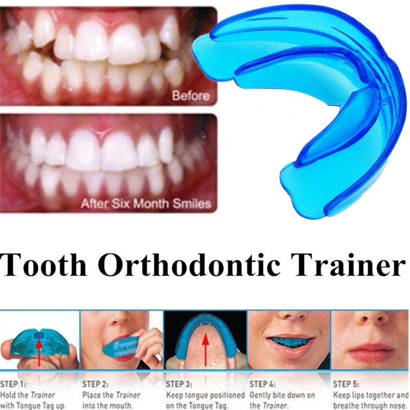 [BISA COD] Alat Perapi Gigi Karet Biru Perata Gigi Pelurus Gigi Teeth Trainer Alignment Original