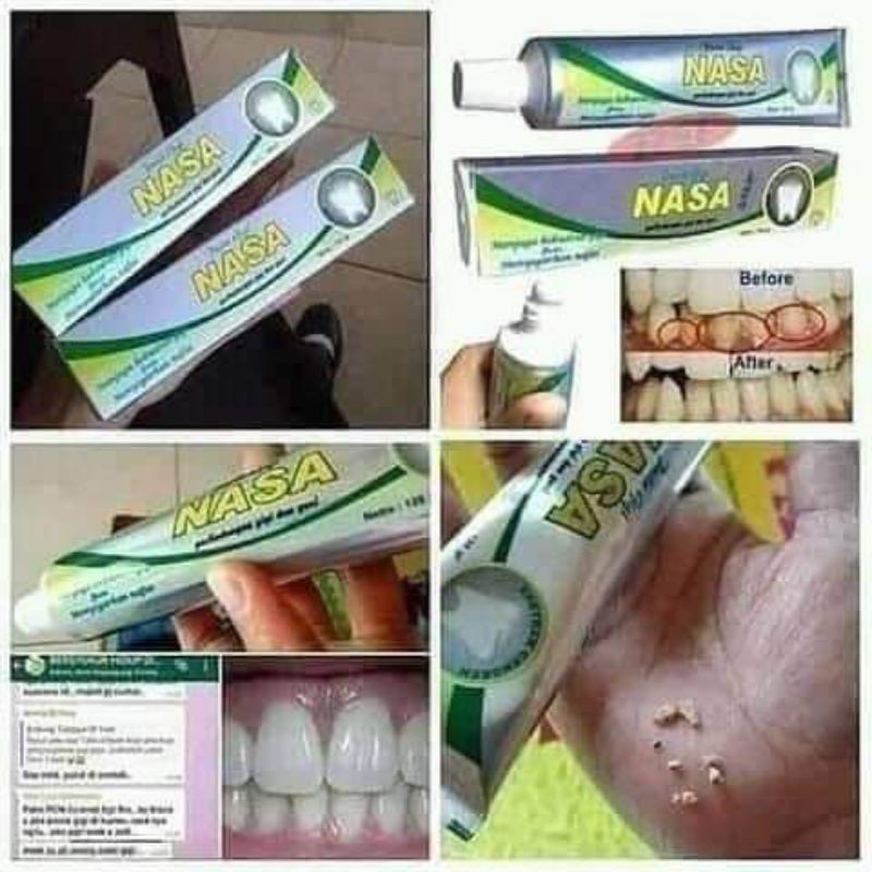 

Pastagigi