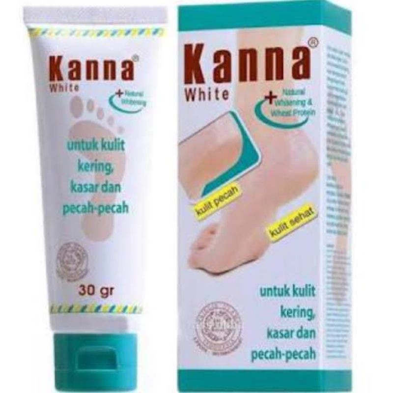 Kanna Krim Lembut 30ml // Krim White 30 ml [[SIZE BESAR]] ORIGINAL-BPOM