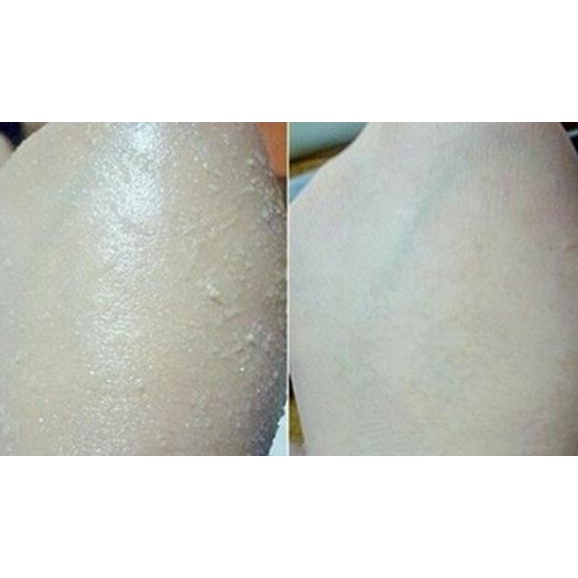 KOZUI MINERAL PEELING SOLUTION for BODY