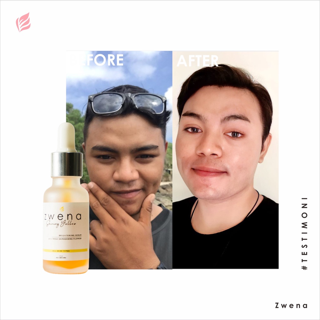 Zwena Brightening Serum Perawatan Kecantikan Wajah, Flek Hitam dan Kerutan Essence Brightening Niacinamide Original BPOM