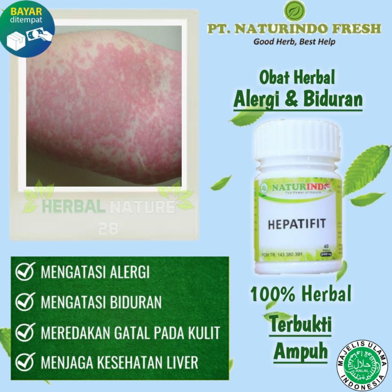 Obat Herbal Alergi Biduran & Kesehatan Liver Hepatifit Jamu sehat Naturindo