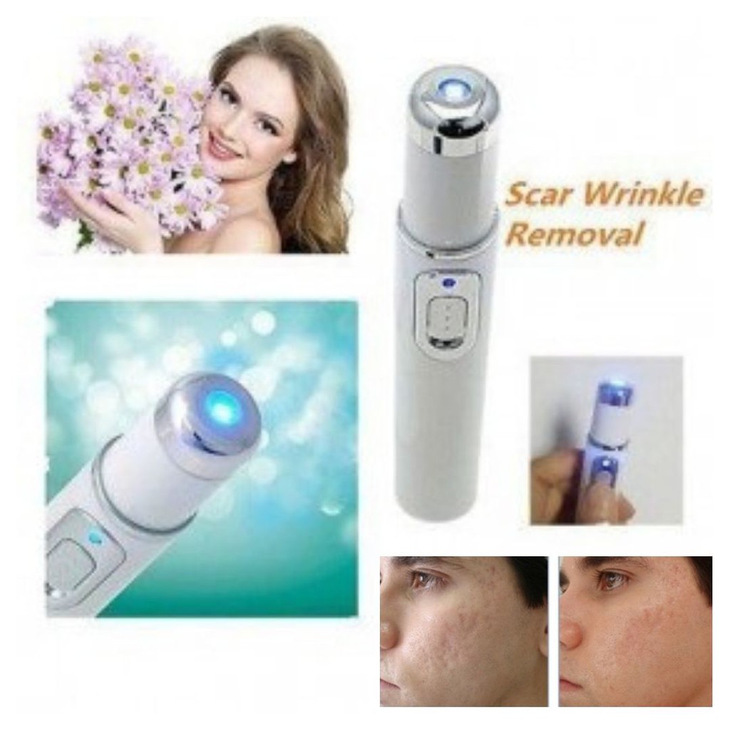 Laser Pen Alat Penghilang Jerawat Blue Light Ray Acne Treatment 111