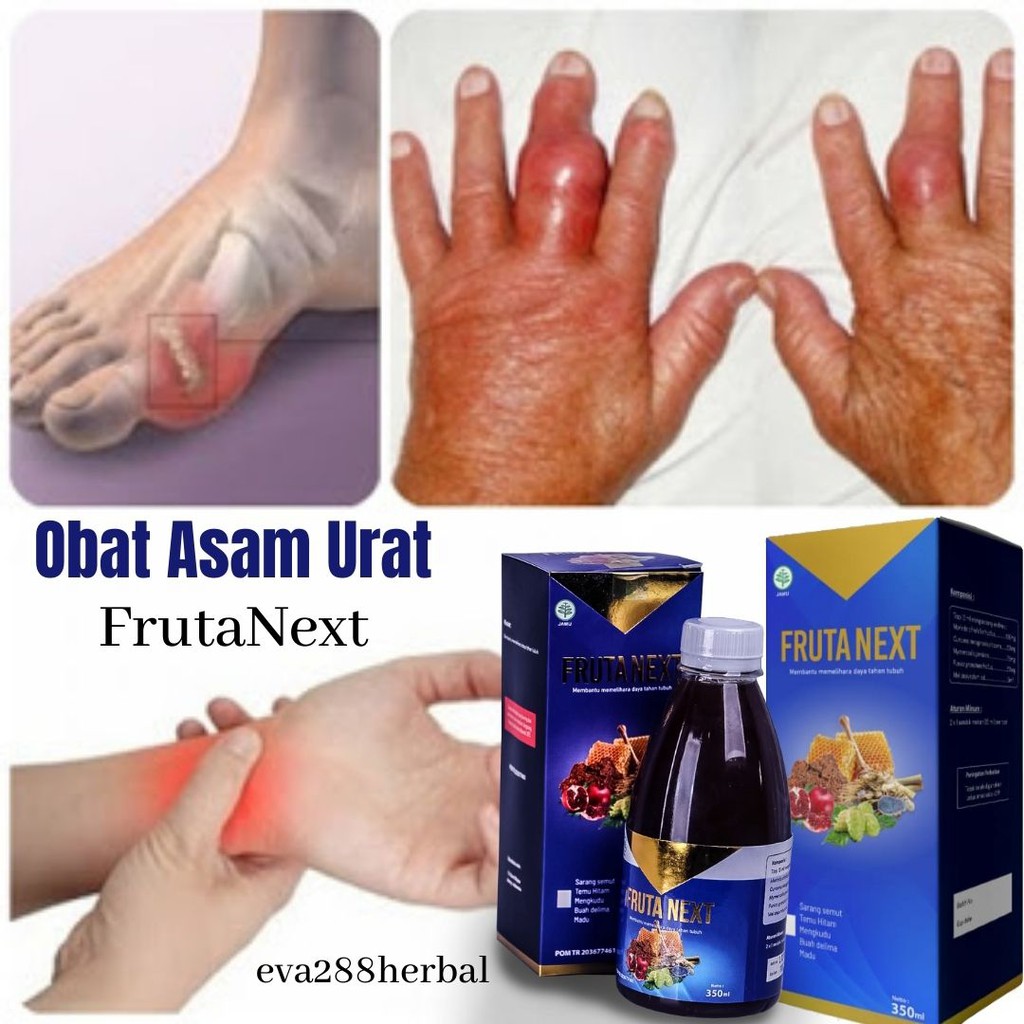 Frutanext Obat Asam Urat Paling Ampuh Original