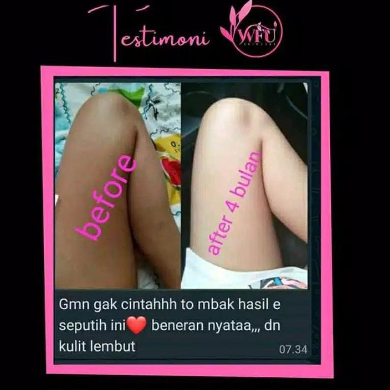 Produk // 9TDET LOTION/HB WFU BPOM(WFU SKINCARE) //Harga Murah